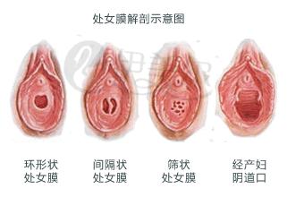 廊坊处女膜修补哪家医院最好?