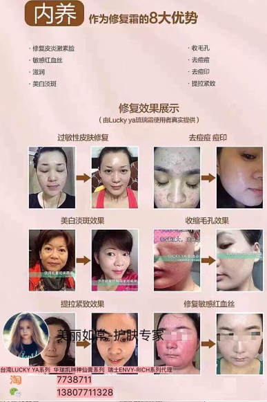 LUCKY-YA能量琉璃霜 ENVY-RICH玻尿酸招代